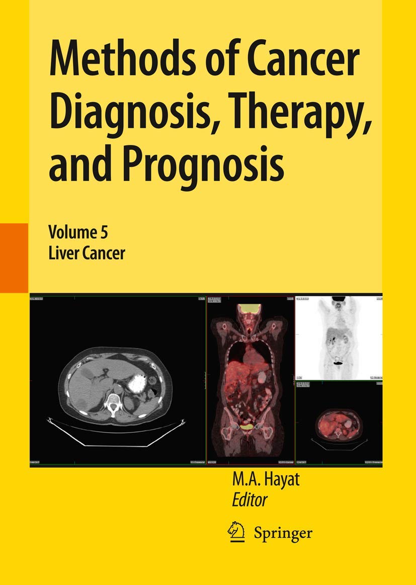 Methods of Cancer Diagnosis, Therapy, and Prognosis cover