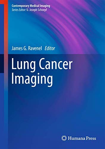 Lung Cancer Imaging cover