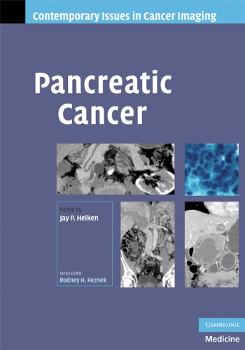 Pancreatic Cancer cover