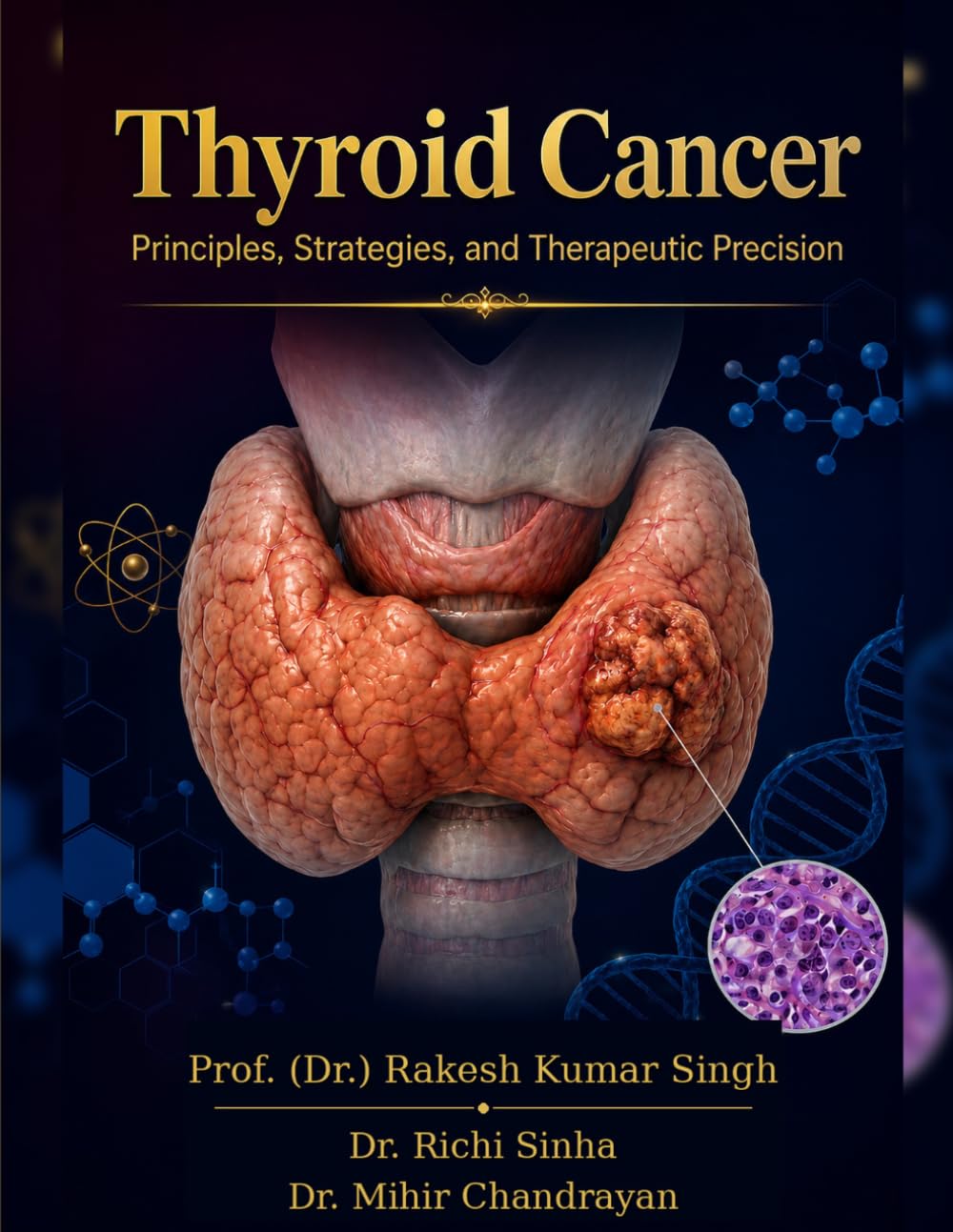 Thyroid Cancer cover
